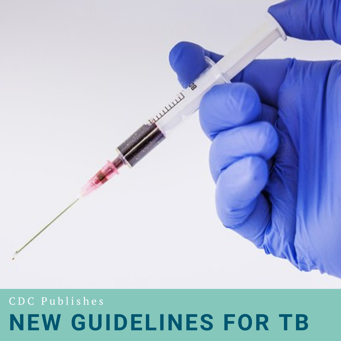 CDC Publishes New Guidelines for TB Image